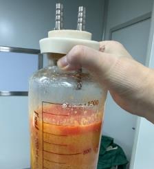 文昌水动力吸脂手术要做多久？